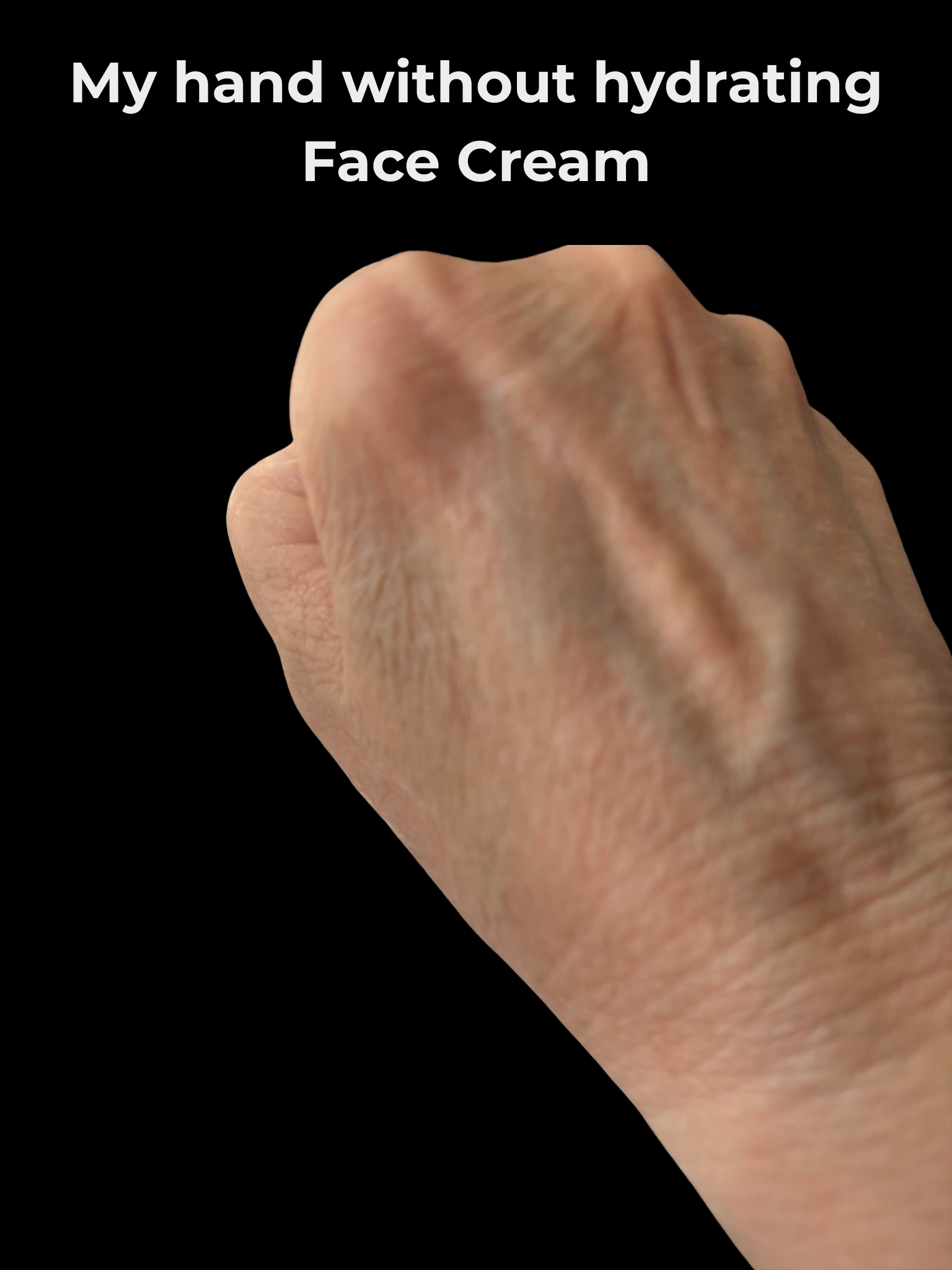 Hand with dry skin on a black background with text 'My hand without hydrating Face Cream'.